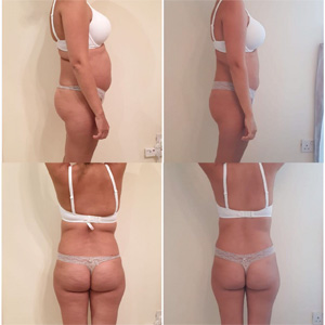calorie-testimonios-kenia